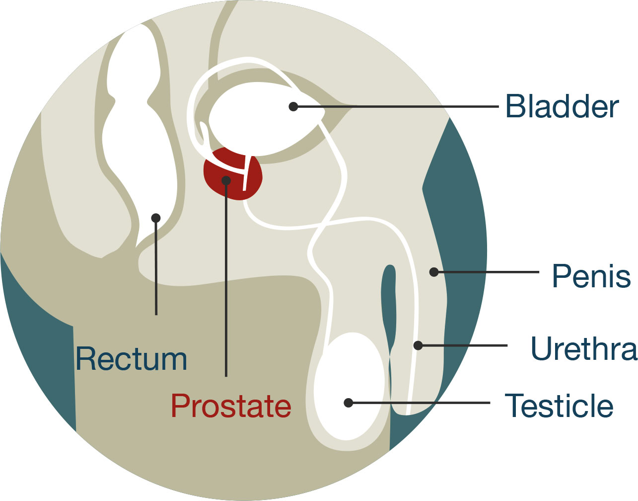 Prostate cancer | Ministry of Health NZ