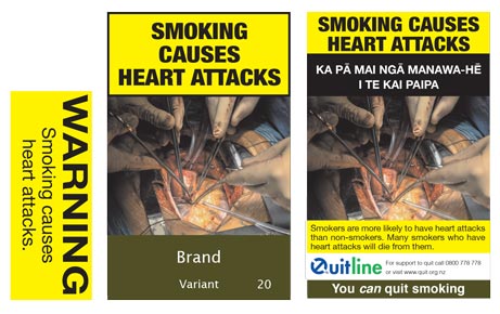 Smoking causes heart attacks