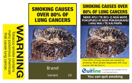 Smoking causes over 80% of lung cancers