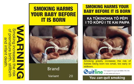 Smoking harms your baby before it is born