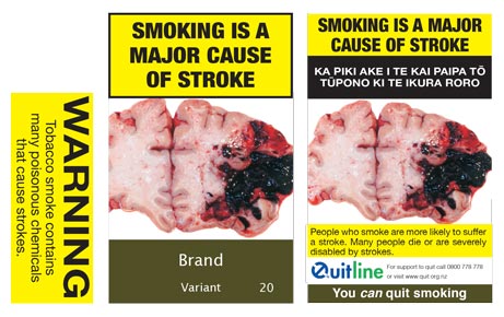 Smoking is a major cause of stroke