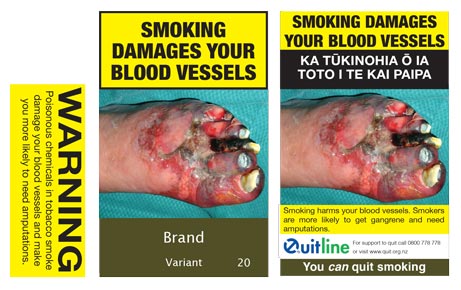 Smoking damages your blood vessels