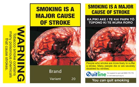 Smoking is a major cause of stroke
