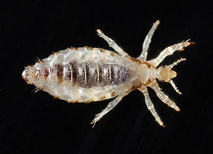 Photo of a body louse. 