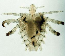 Photo of a pubic louse. 