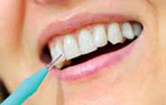 A woman using an inter-dental brush between two of her teeth. 