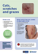 Thumbnail of Cuts, scratches and grazes print-out version. 